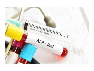 Alkaline phosphatase isoenzymes