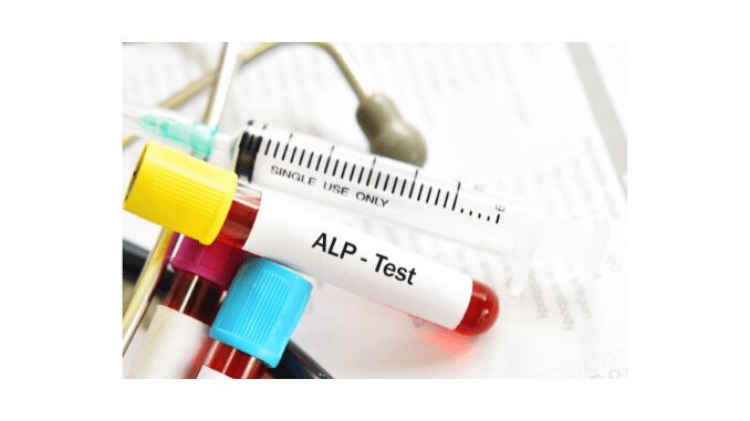 Alkaline phosphatase isoenzymes