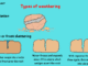 Types of weathering