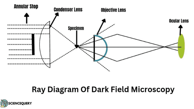 Dark Field Microscope