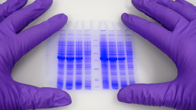 2D-gels