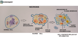 Necrosis